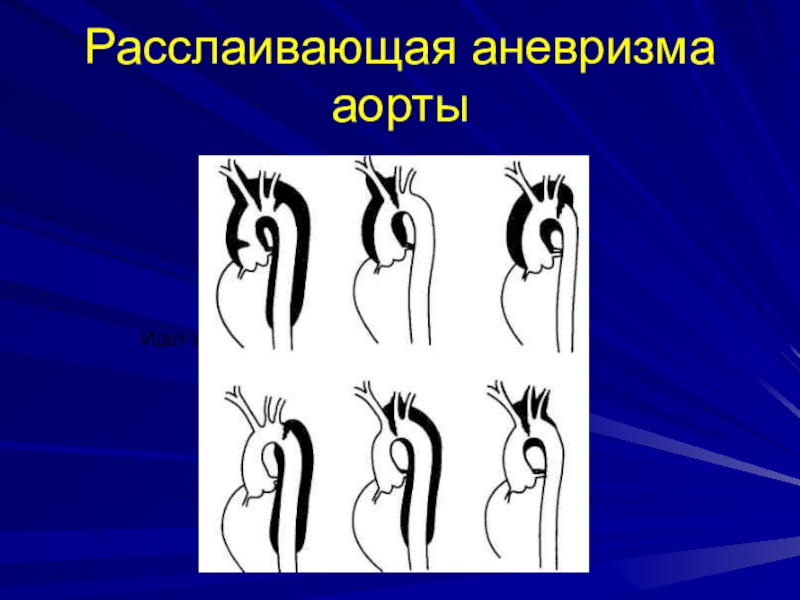 Расслаивающая аневризма карта вызова