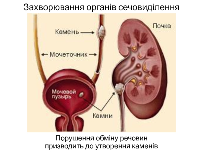 Мочеточник на картинке