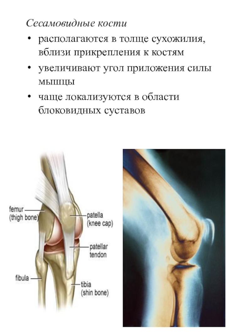 Сесамовидные кости. Коленная чашечка сесамовидная кость. Сесамовидные кости функции. Сесамовидная кость икроножной мышцы.