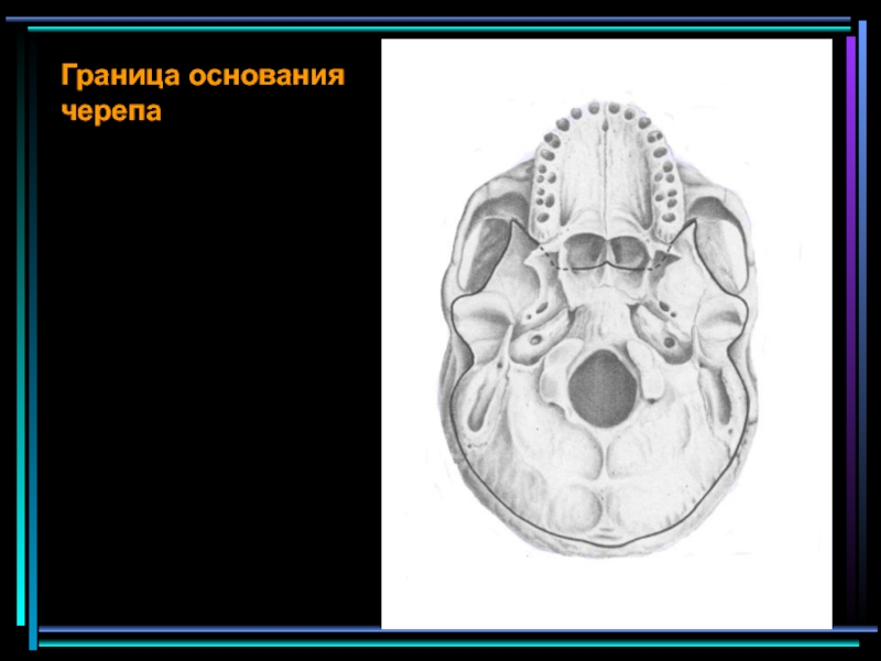 Почему болит основание черепа. Мышцы основания черепа. пространства черепа. наружное основание черепа. топография основания черепа.