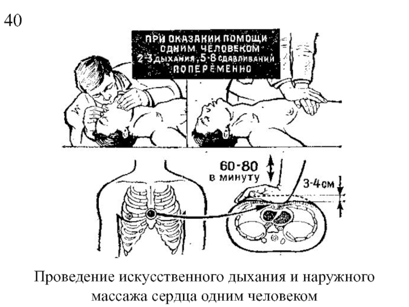 Презентация искусственное дыхание и массаж сердца