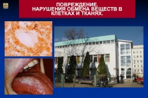 Повреждения. Нарушение обмена веществ в клетках и тканях