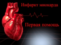 Инфаркт миокарда - Первая помощь