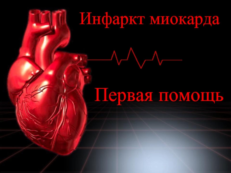 Презентация Инфаркт миокарда - Первая помощь