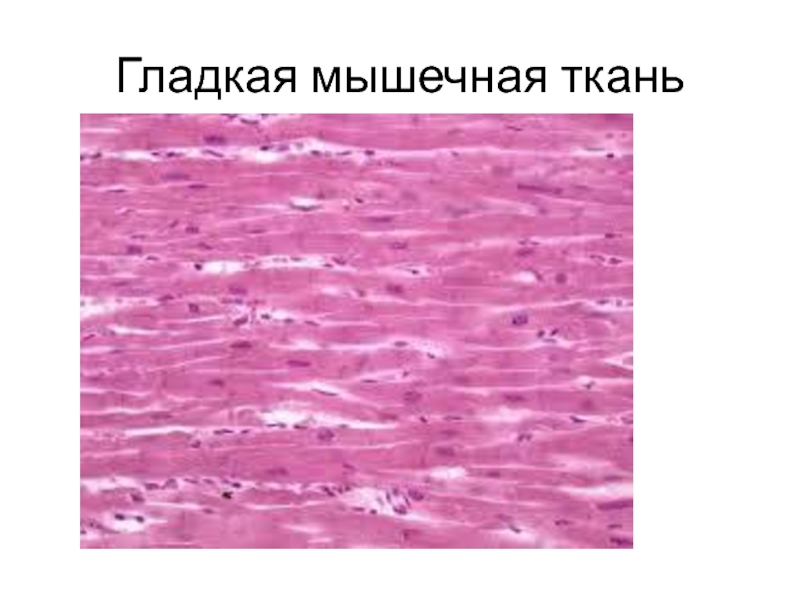 Картинка гладкой мышечной ткани