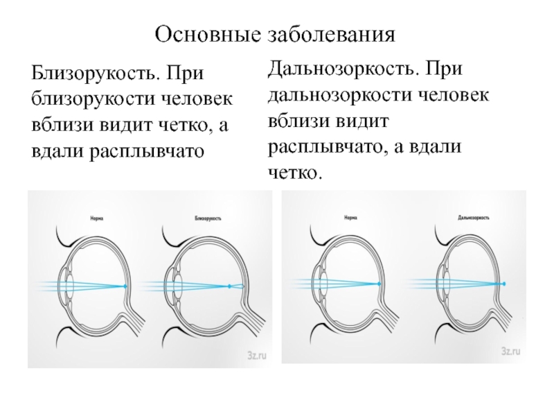 Расплывчатое изображение близкорасположенных предметов является признаком близорукости