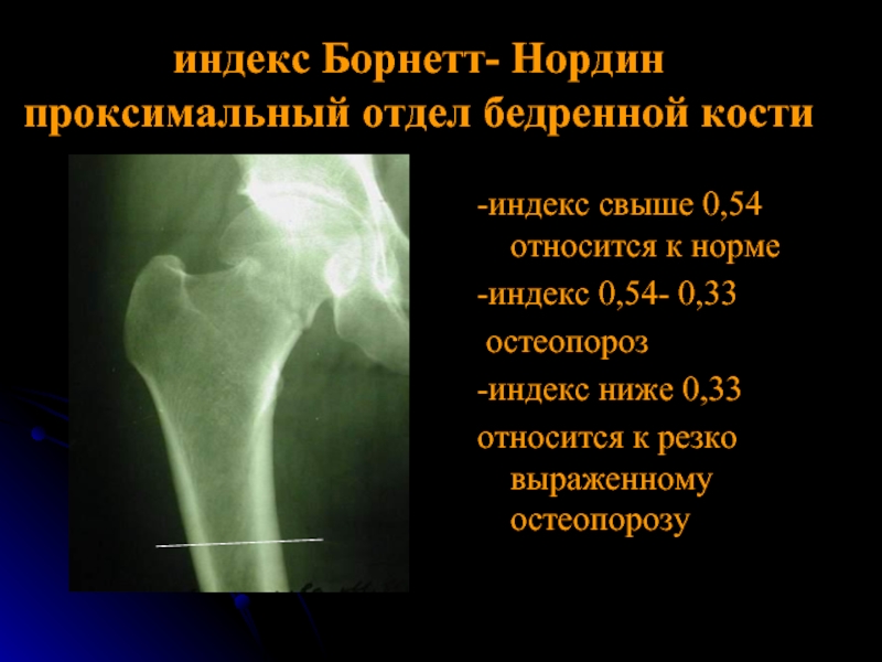 Анализ кости на остеопороз