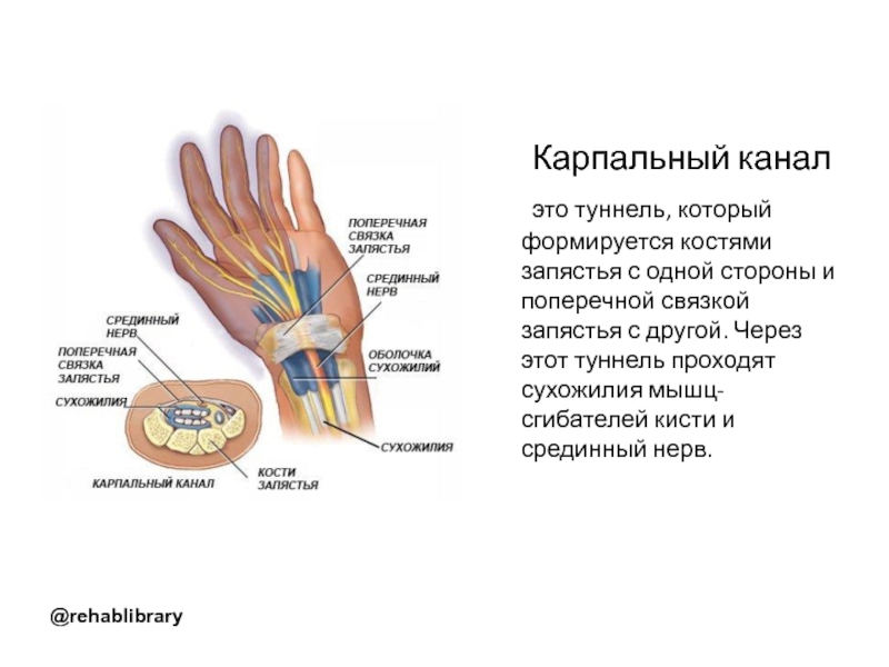 Синдром карпального канала мкб 10. Карпальный синдром лучезапястного сустава. Карпальный туннель запястья анатомия. Карпальный канал кости анатомия. Запястный канал схема.