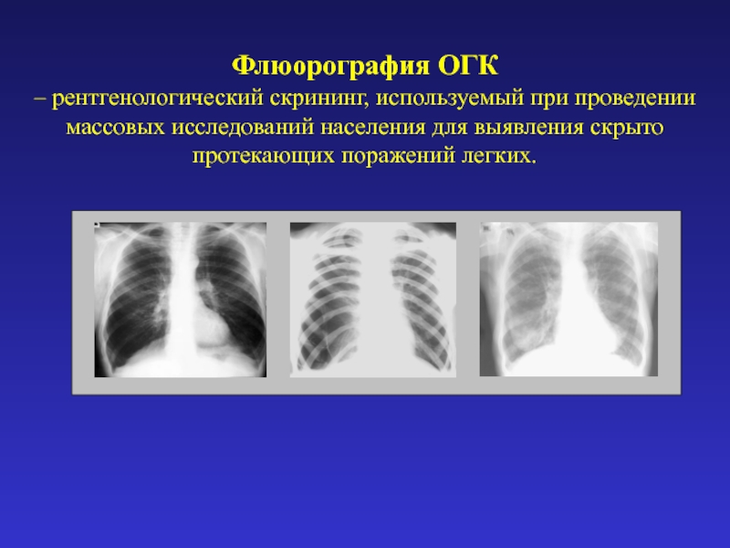 Компьютерная флюорография презентация