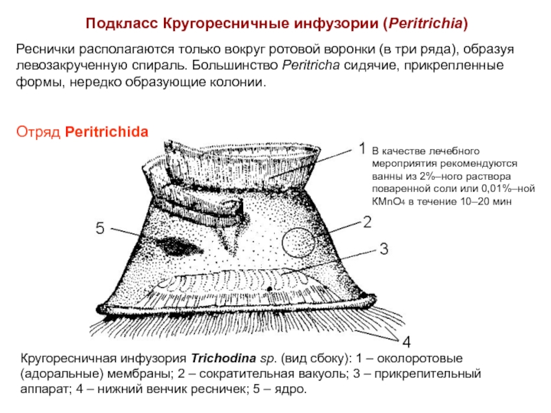 Колония образующая. Кругоресничные инфузории. Кругоресничная инфузория строение. Отряд Кругоресничные. Инфузория триходина отряд.