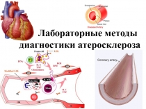 Лабораторные методы диагностики атеросклероза