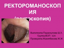 РЕКТОРОМАНОСКОПИЯ (ректоскопия)