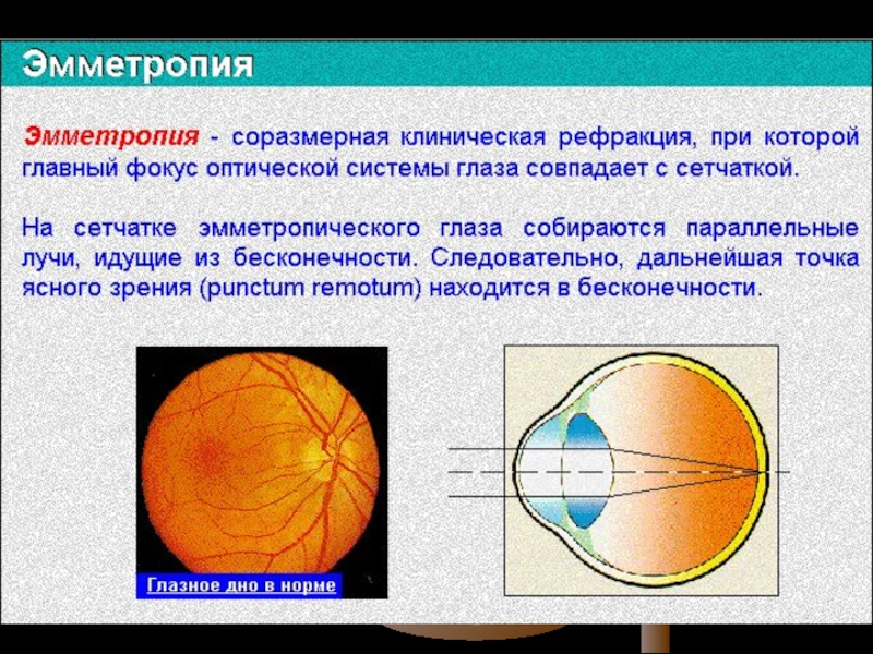 Аккомодация офтальмология презентация