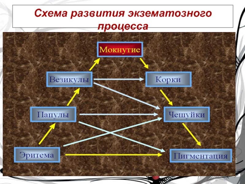 Схема развития. Треугольник крейбиха. Схема развития для презентации. (Стадии) экзематозного процесса:(стадии) экзематозного процесса.