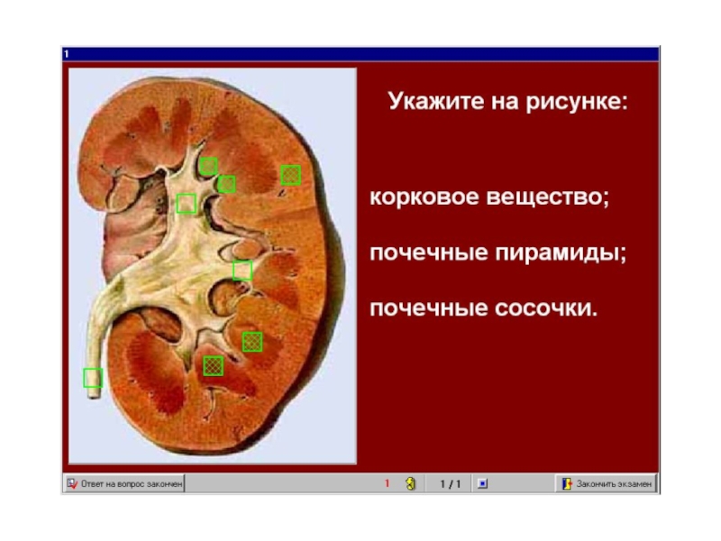 мочеполовая.ppt