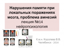 Нарушения памяти при локальных поражениях мозга, проблема амнезий лекция №14