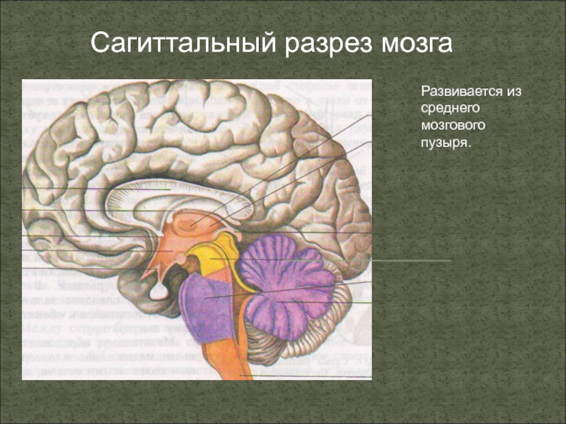 Общий план строения мозга в сагиттальном разрезе