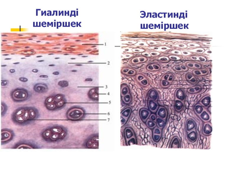 Гиалиновая хрящевая ткань гистология