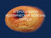 Атеросклероз-ИБС-2011.ppt