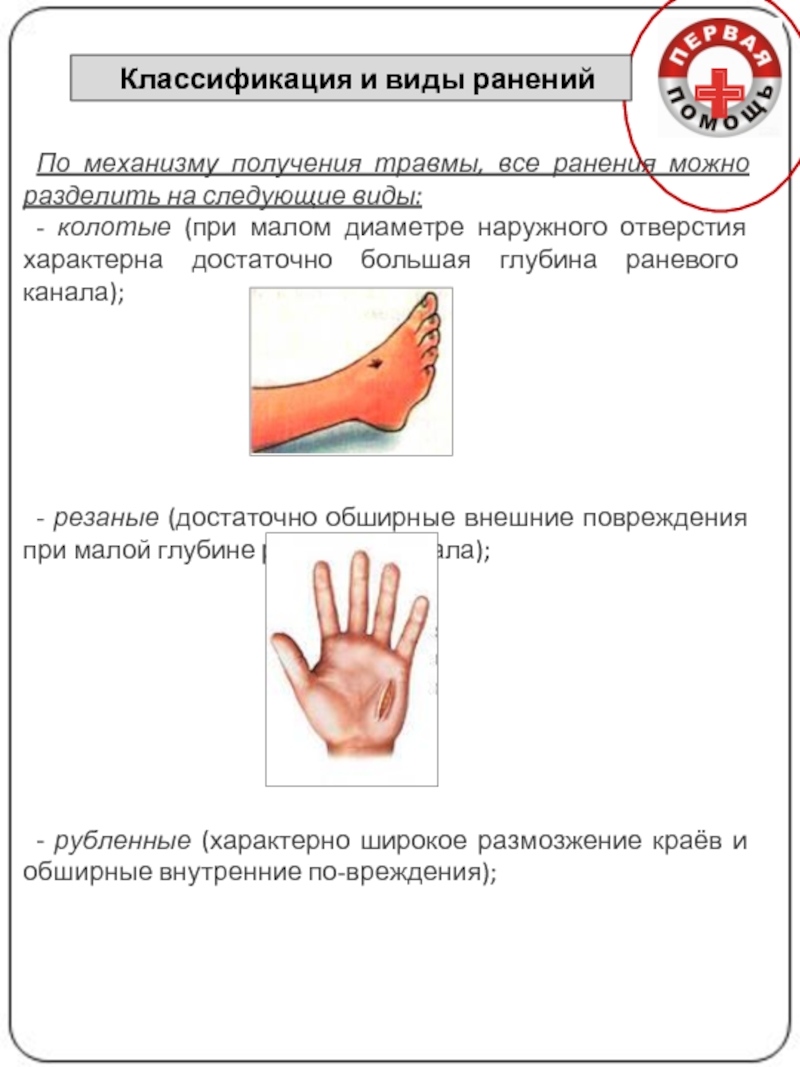 Резаная рана запястья карта вызова смп