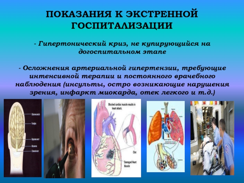 Осложнения артериальной гипертензии. Гипертонический криз показания к госпитализации. Показания к госпитализации при артериальной гипертензии. Показания для госпитализации больных артериальной гипертонией. Гипертонический криз госпитализации гипертонический показания.