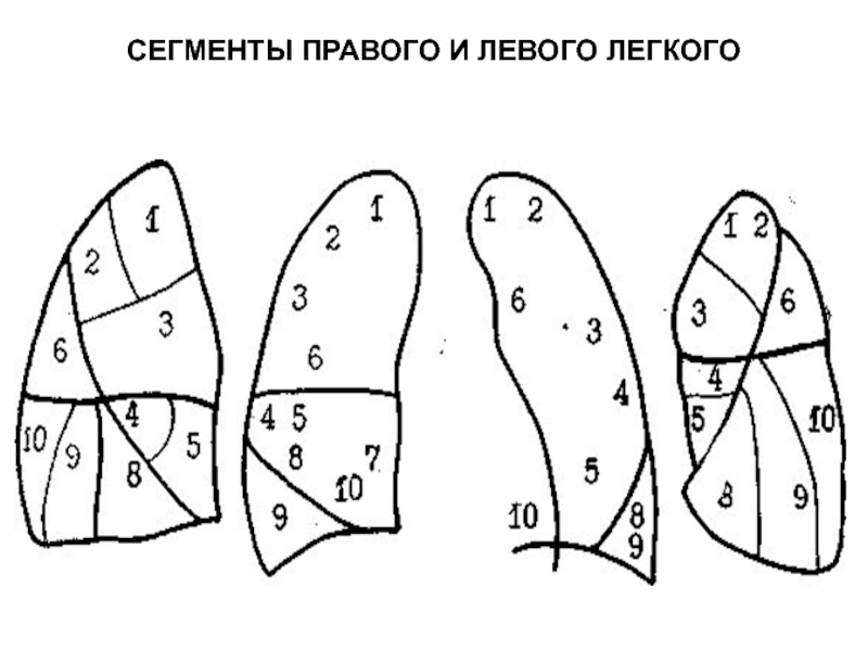 Бронхолегочные сегменты схема