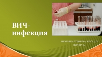 ВИЧ-инфекция