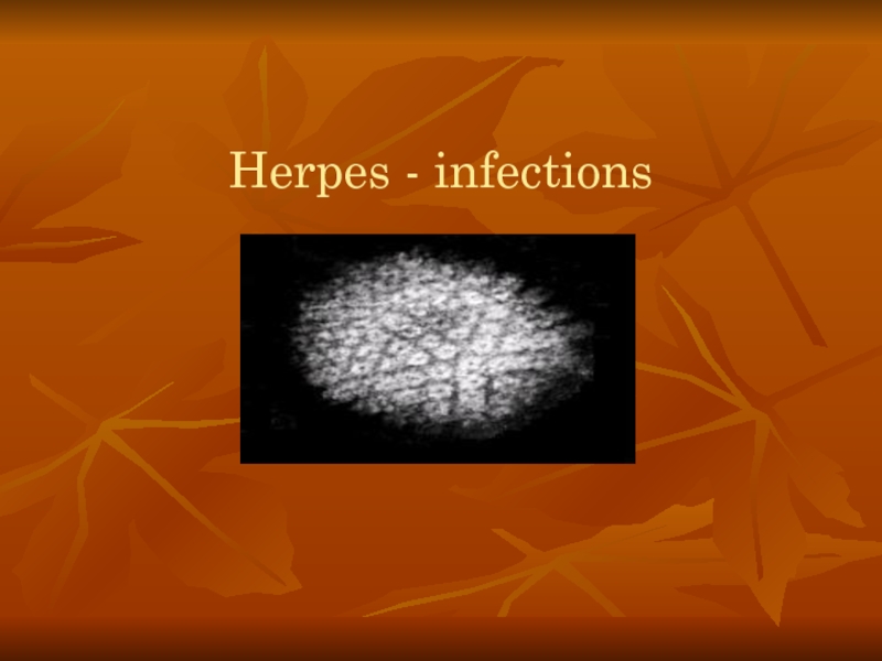 Herpes - infections