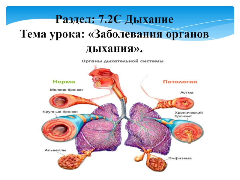 Заболевание органов дыхания биология. Заболевания органов дыхания тема урока. Презентация на тему заболевания органов дыхания. Презентация по биологии болезни органов дыхания 8 класс. Реферат на тему заболевания органов дыхания биология 8 класса.