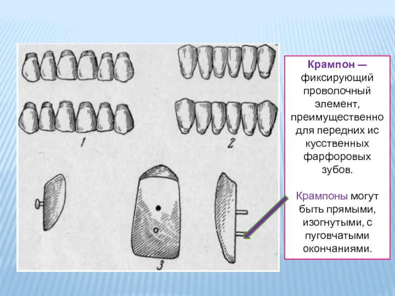 Искусственные зубы презентация