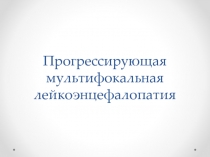 Прогрессирующая мультифокальная лейкоэнцефалопатия