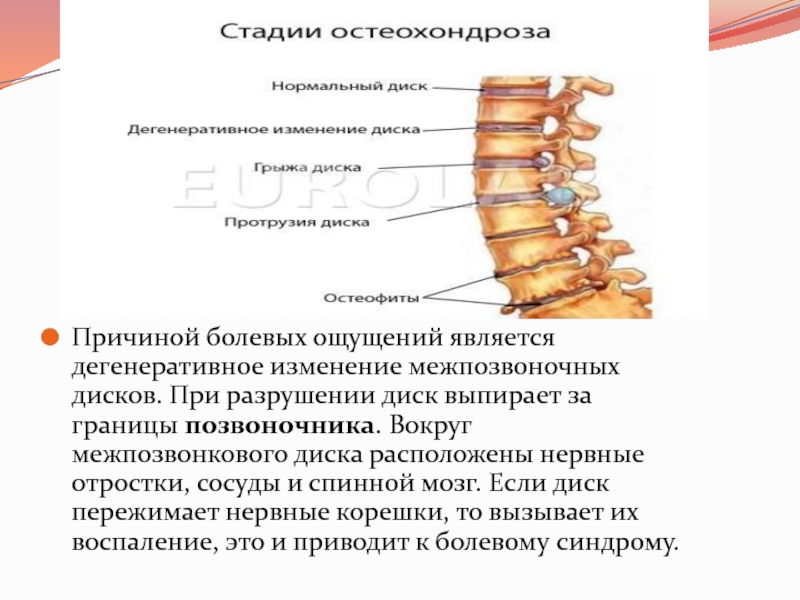 Дегенеративные изменения позвоночника что это