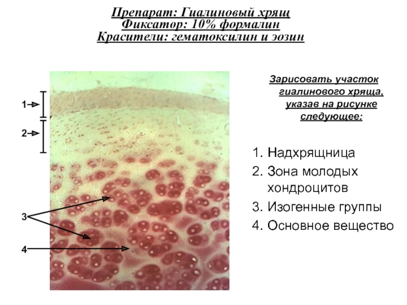 Эластический хрящ гистология рисунок