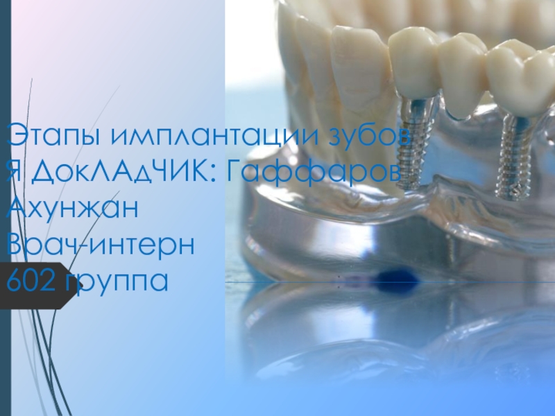 Этапы имплантации зубов Я ДокЛАдЧИК : Гаффаров Ахунжан Врач-интерн 602 группа