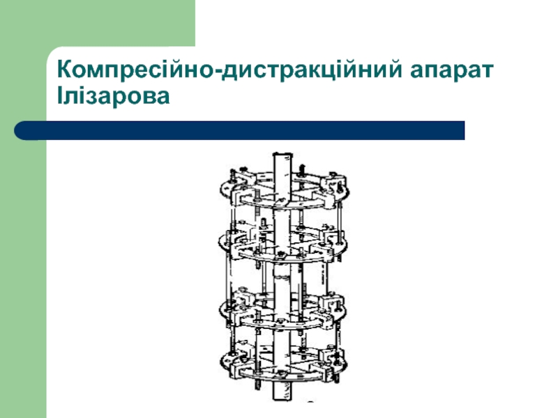 Схема центра илизарова