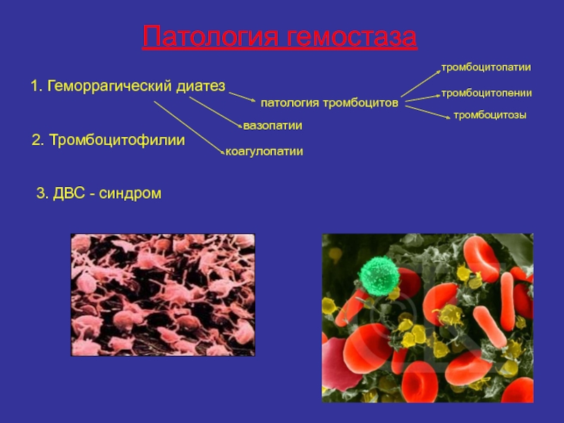 Патология гемостаза1. Геморрагический диатезпатология тромбоцитовтромбоцитопатиитромбоцитопении  тромбоцитозывазопатиикоагулопатии2. Тромбоцитофилии3. ДВС - синдром