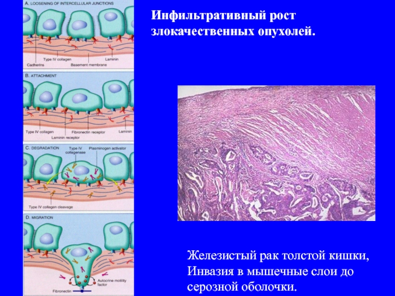 Экспансивный рост рисунок