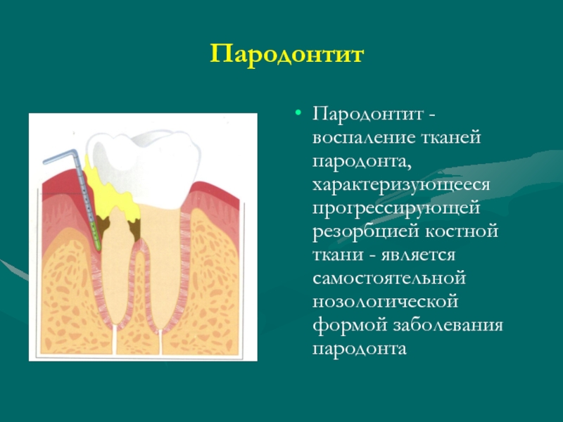 Анатомия пародонта презентация