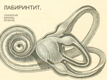 Лабиринтит. ЭТИОЛОГИЯ. КЛИНИКА. ЛЕЧЕНИЕ.