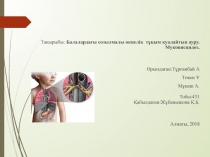 Тақырыбы: Балалардағы созылмалы өкпелік тұқым қуалайтын ауру. Муковисцидоз
