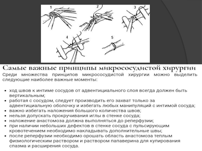 Лоскуты на микрососудистом анастомозе применяемые в челюстно лицевой хирургии презентация