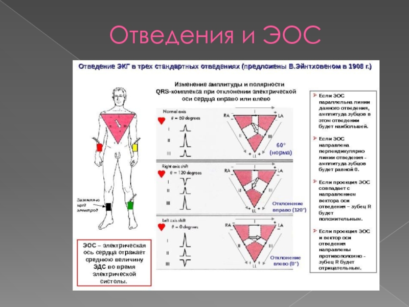 Картинка стандартные отведения