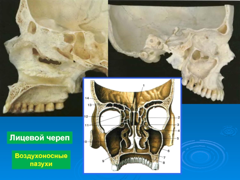 Носовая кость лицевого черепа. Воздухоносные пазухи черепа анатомия. Гайморова (верхнечелюстная) пазуха черепа. Кости с воздухоносными пазухами. Кости гайморовой пазухи.