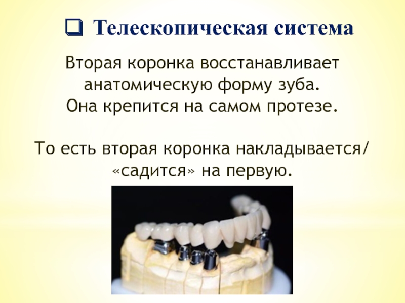 Телескопическая системаВторая коронка восстанавливает анатомическую форму зуба.Она крепится на самом протезе.То есть вторая коронка накладывается/«садится» на первую.
