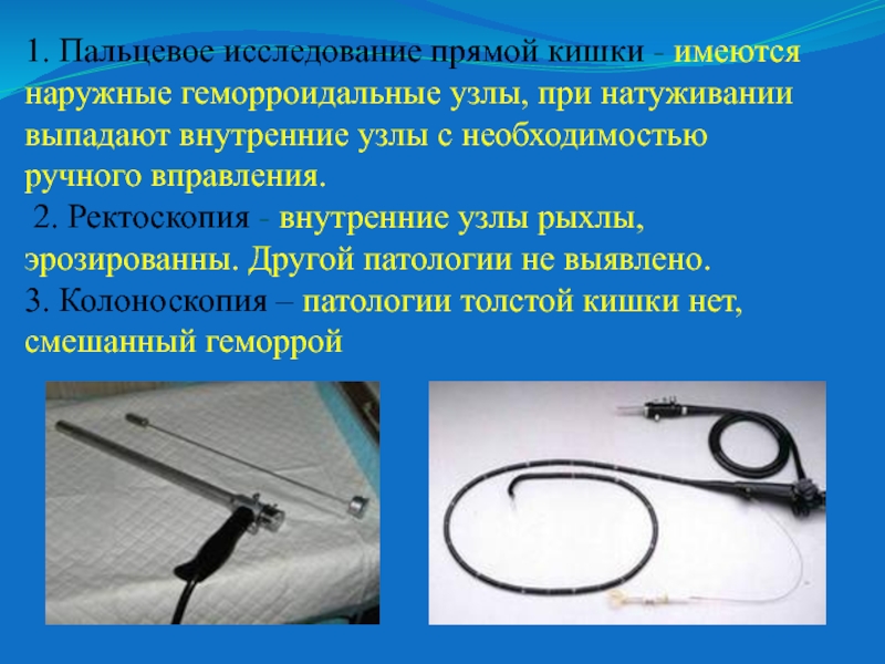 Исследование прямой кишки. Пальцевое обследование прямой кишки. Палцевое исследованиепрямой кишки. Осмотр прямой кишки пальцевое исследование. Методы обследования прямой кишки пальцевое исследование.