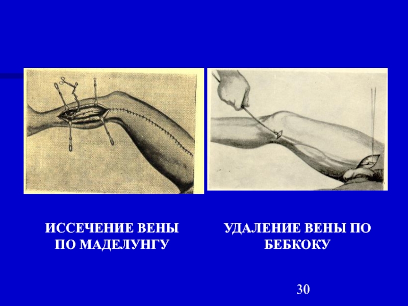 Радиоволновая болезнь презентация