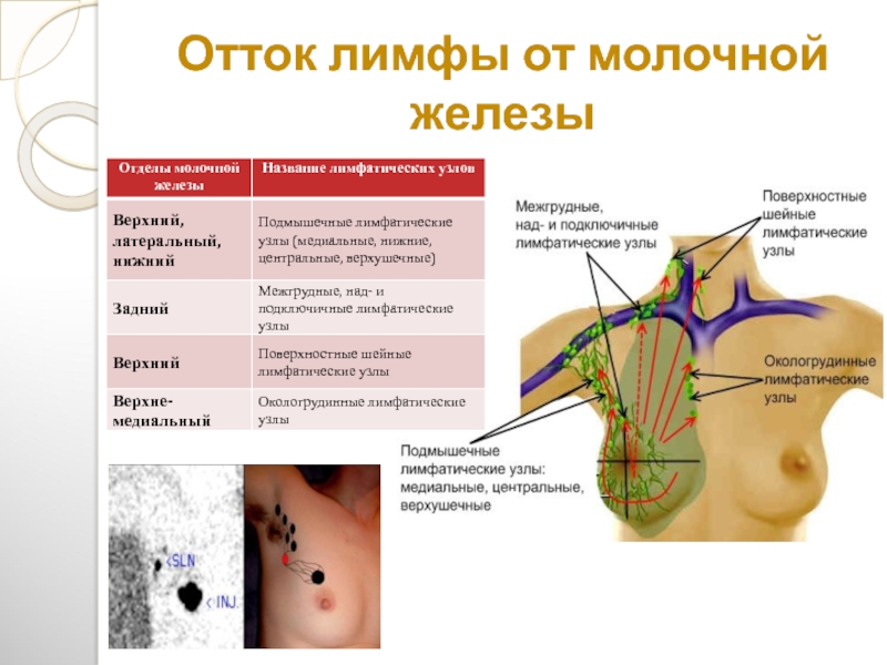 Где находятся лимфоузлы в подмышках схема у женщин