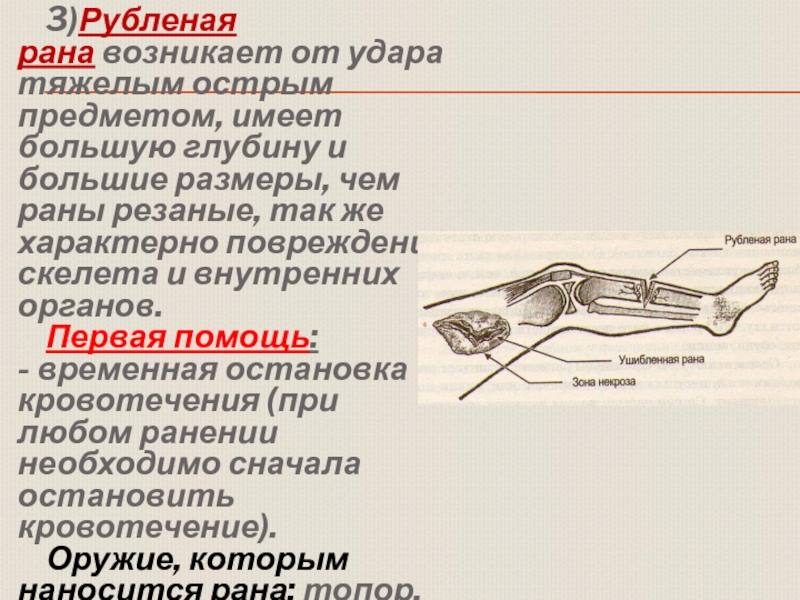 Первая помощь при ранениях обж 11 класс презентация