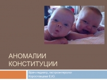 Аномалии конституции