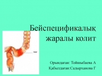 Бейспецификалық жаралы колит
Орындаған: Тойшыбаева А
Қабылдаған:Садырханова Г